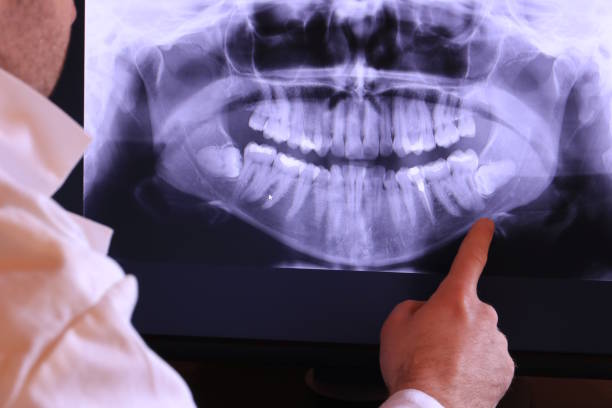 Best Emergency Treatment for Jaw Pain or Injury in Brownstown, PA