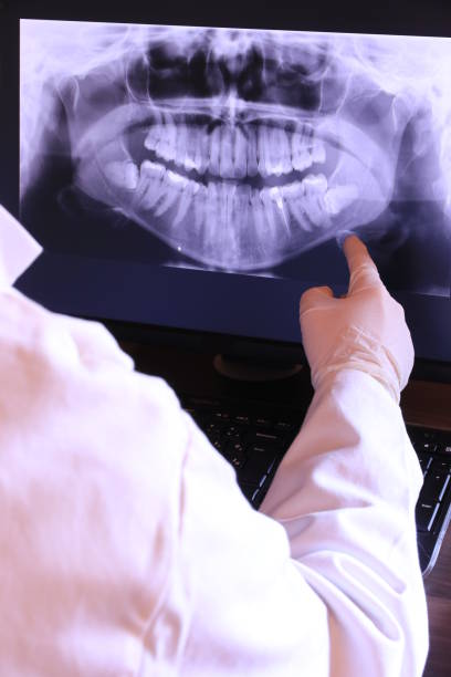 Best Emergency Root Canal Therapy in Brownstown, PA