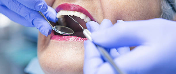 Best Dental Abscess Treatment in Brownstown, PA