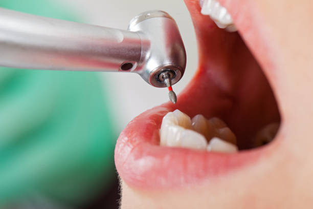 Best Emergency Denture Repair in Brownstown, PA